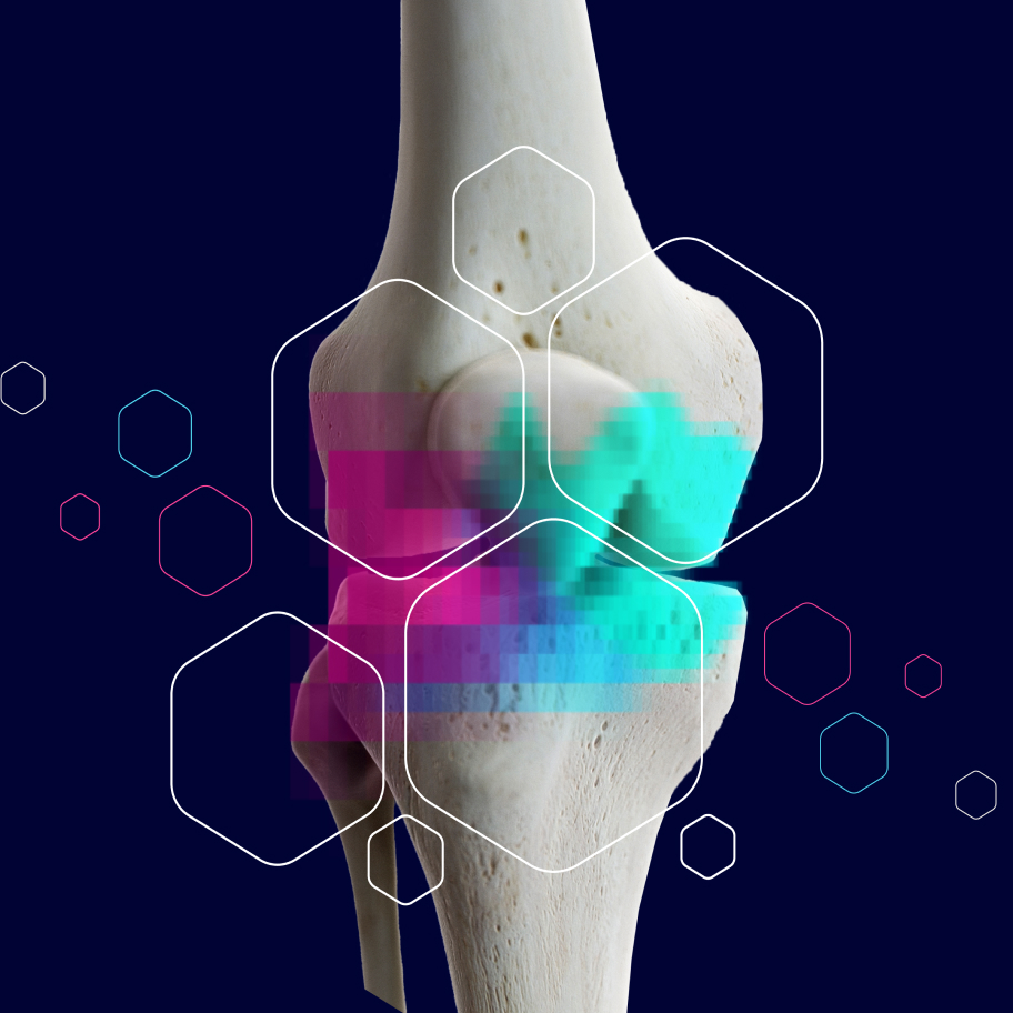 NITRO signature image of a knee joint.